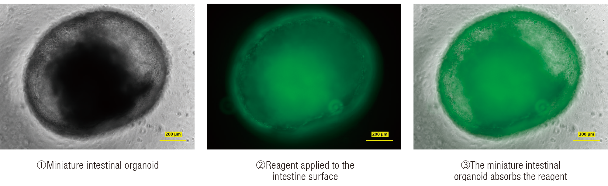 Flow diagram of miniature intestinal absorbing reagents into the intestine